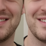 Remarkable Facial Treatment That Will Make You Beautiful